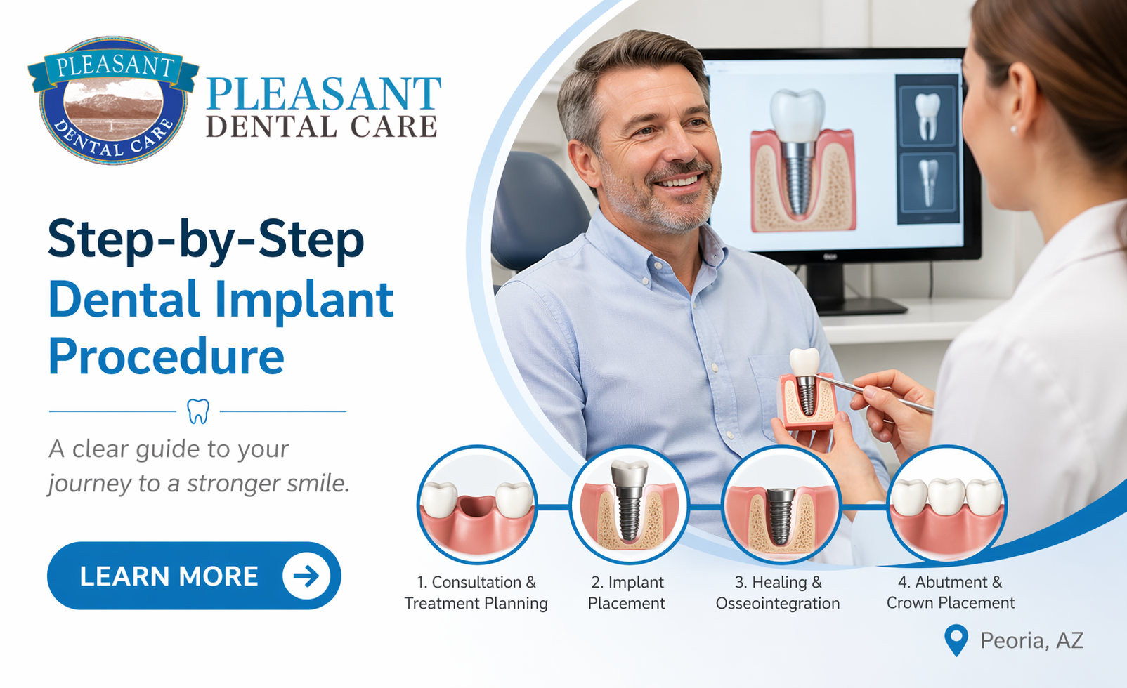 How Does the Dental Implant Procedure Work? Step-by-Step Guide