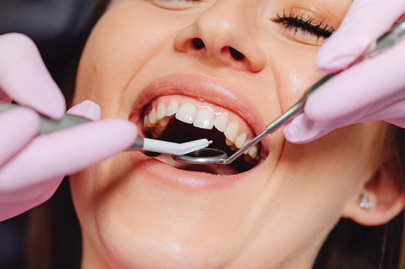 How Long Does a Dental Implant Procedure Take?