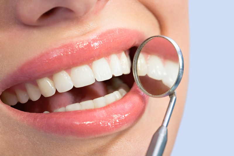 How Often Should You Have Your Teeth Cleaned?