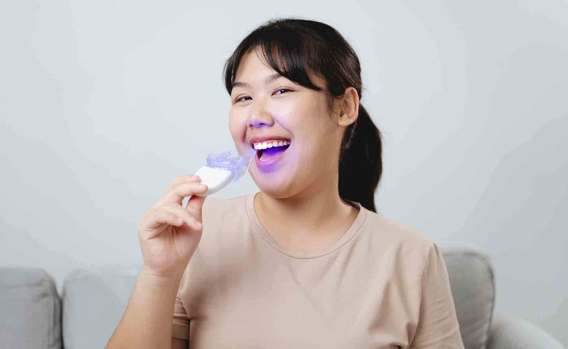 How Often Should You Get Your Teeth Whitened?