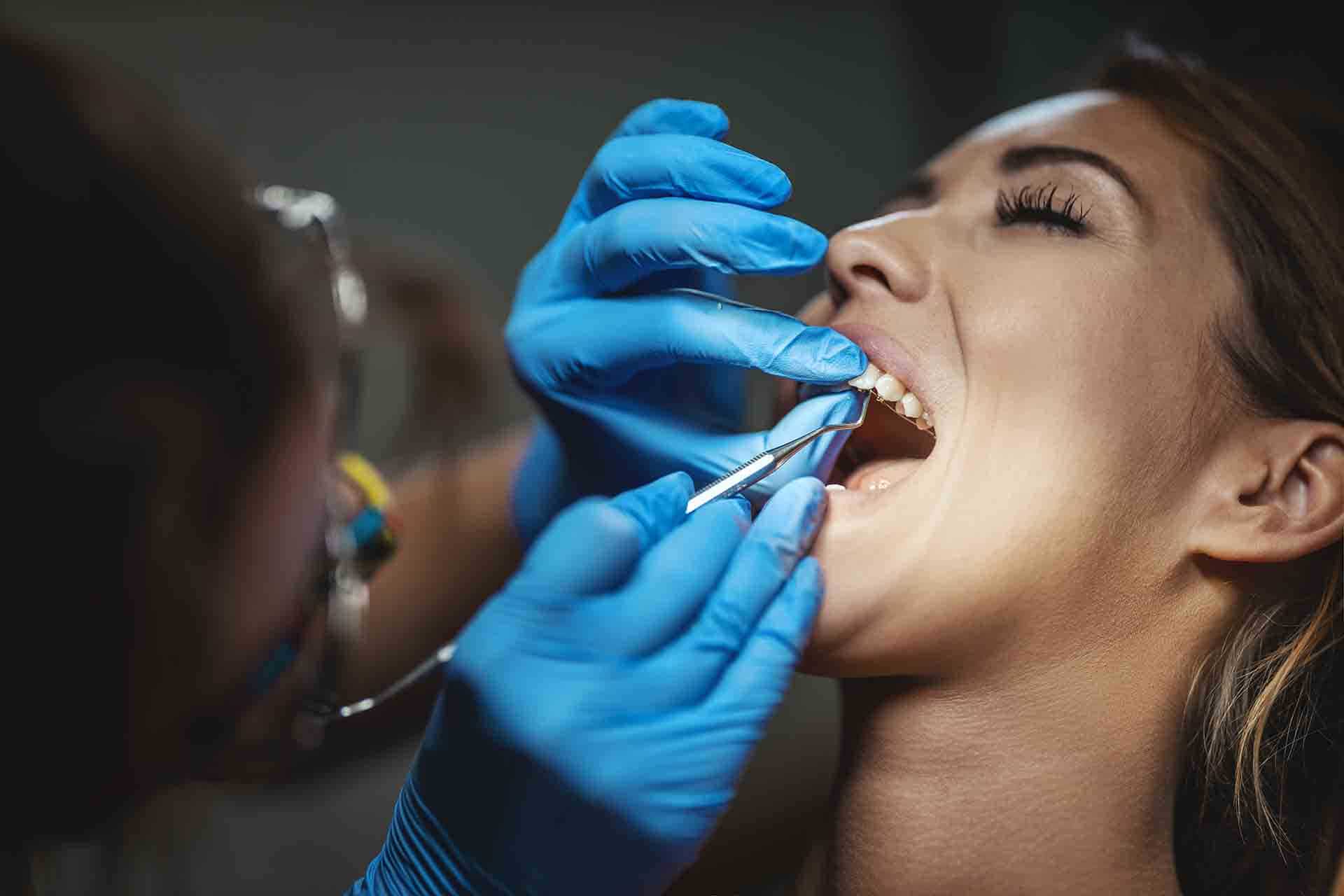 Is Dental Bonding Permanent? Tips to Make Your Bonding Last Longer