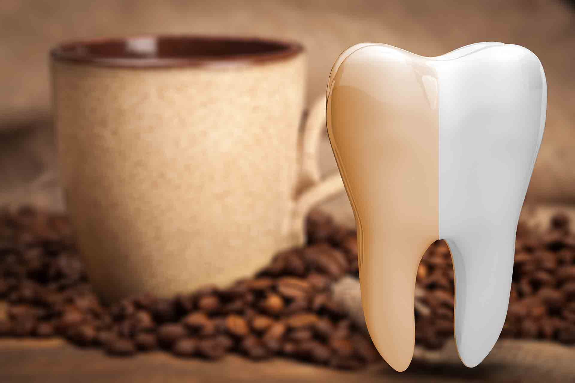Can I Drink Coffee During Teeth Whitening? Here's What You Need to Know